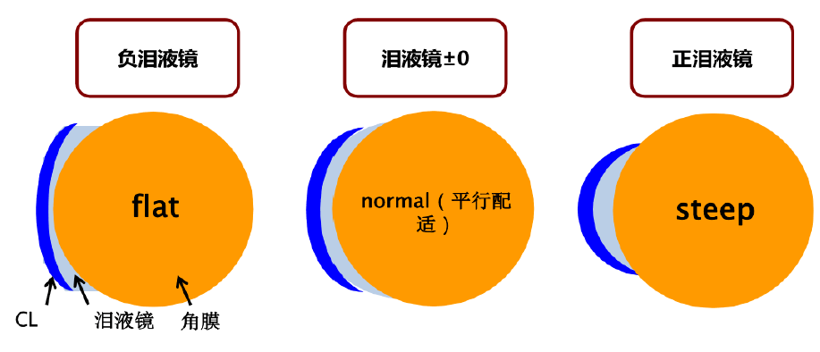 医生版 rgp镜片左右眼怎么区分