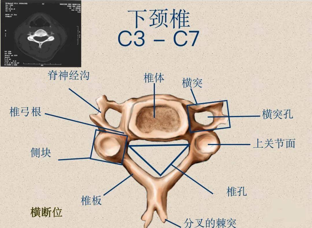 脊柱超詳細解剖,高清圖文版!