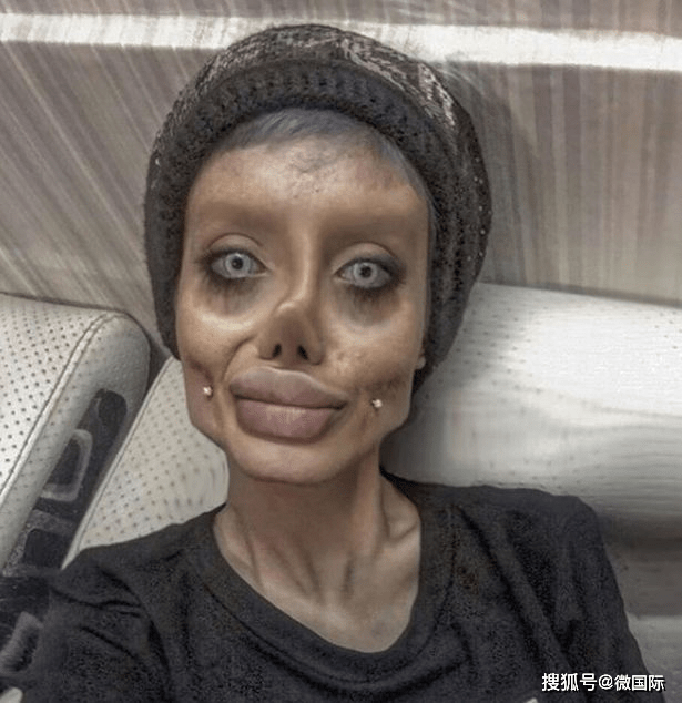 僵尸女孩因在网上发布,自己整容的可怕照片,被判入狱10年
