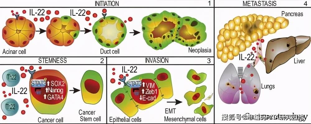 白細胞介素22信號轉導調控腺泡細胞可塑性促進小鼠胰腺腫瘤的發生發展