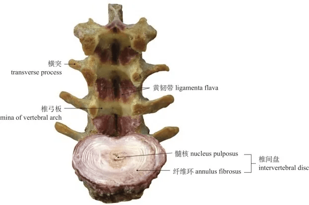 圖1-47 黃韌帶和椎間盤ligamenta flava and intervertebral disc