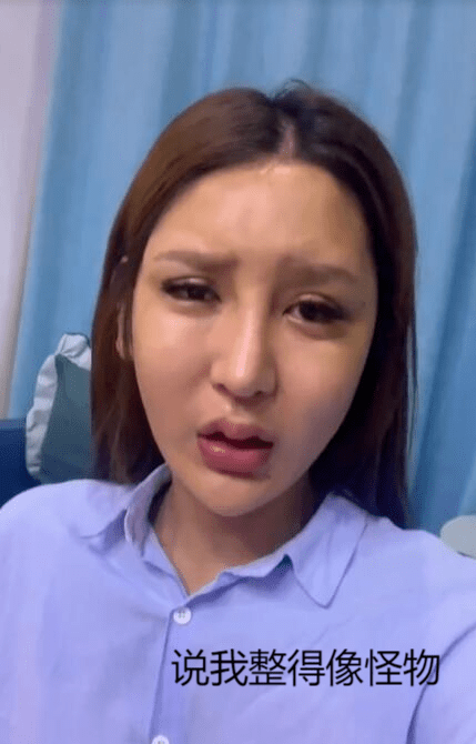 女网红出现整容后遗症被骂怪物,眼睛疯狂抽搐,却口口声声说整容没失败
