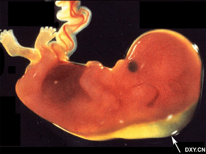 孕十二周男女胎儿图图片