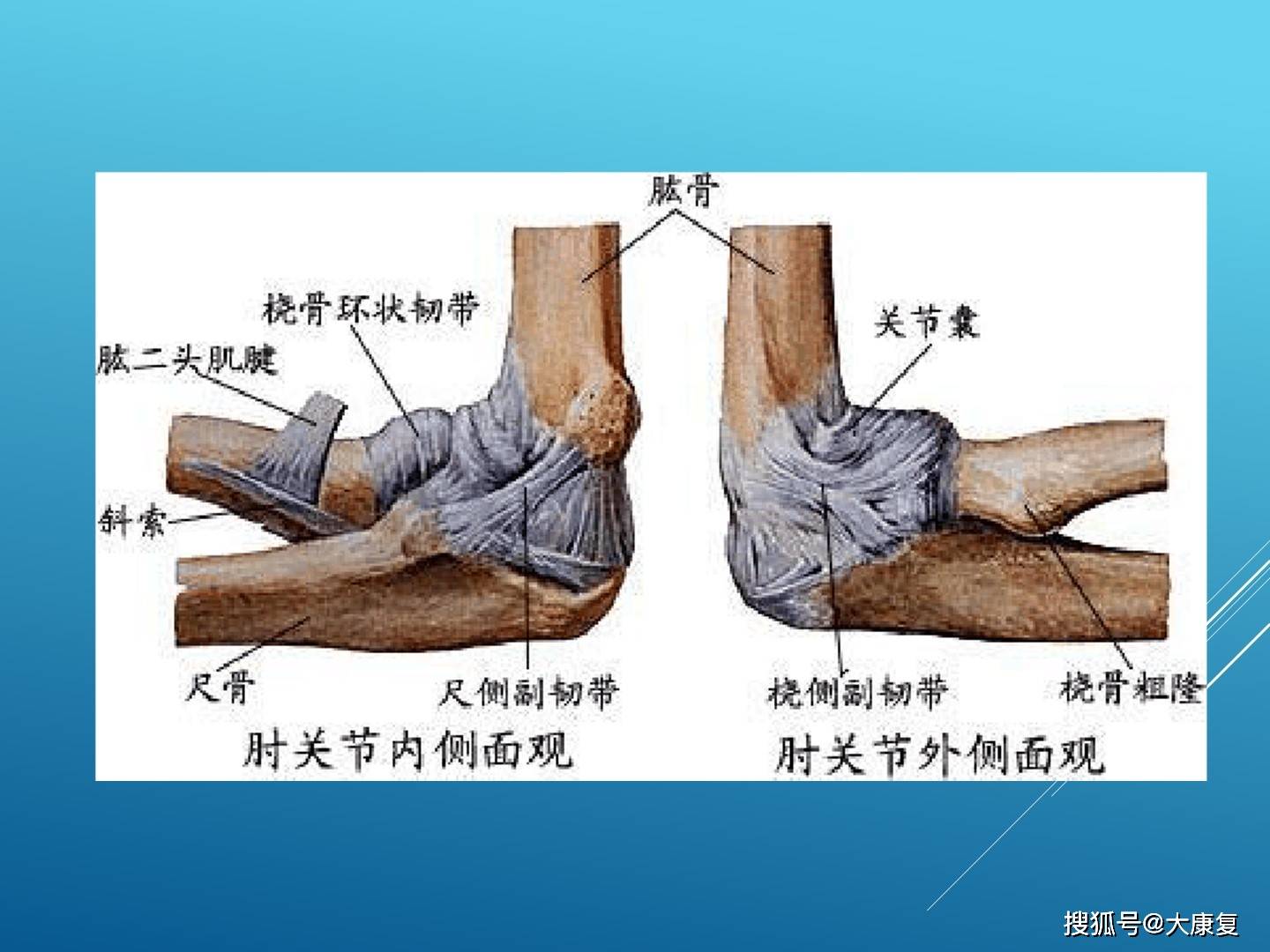 網球肘的成因治