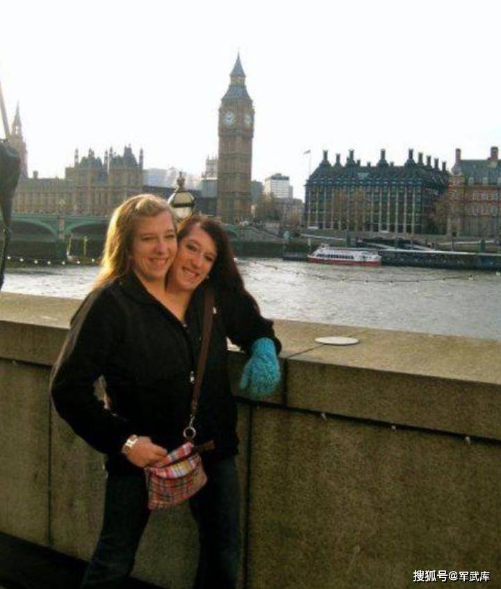 原创美国罕见的双头人姐妹共用同一个身体却爱上不同男人