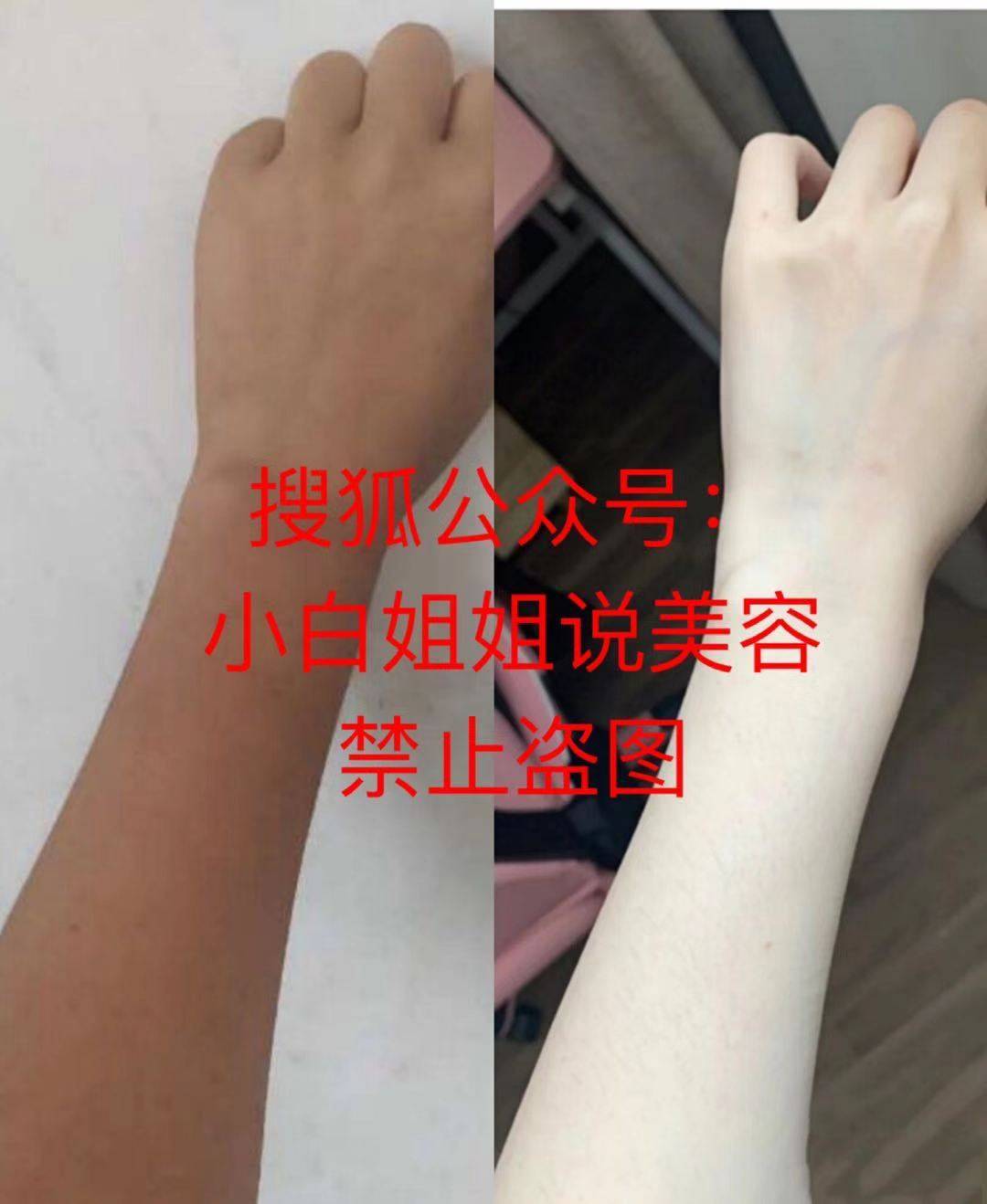 正品|日本铂金美白针为什么不适合天生黑的人？