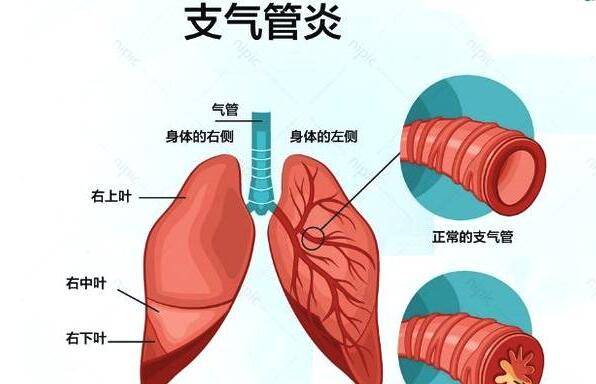 治疗原理是什么意思_根管治疗是什么意思