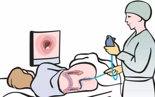 肠镜检查痛苦吗肠镜检查全过程