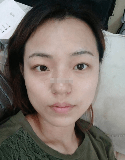 鼻子较小,眼睛大小不一,情绪不稳定,易发脾气