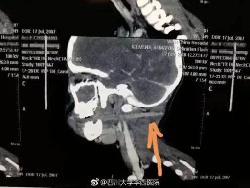 侯府诱春42_光棍影院在线_宝宝老公想要你了