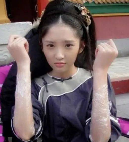 原创张若为什么会死心塌地爱唐艺昕九年,唐艺昕整容后却不火了