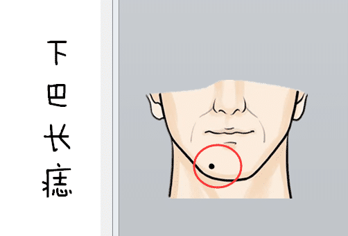 身上4顆