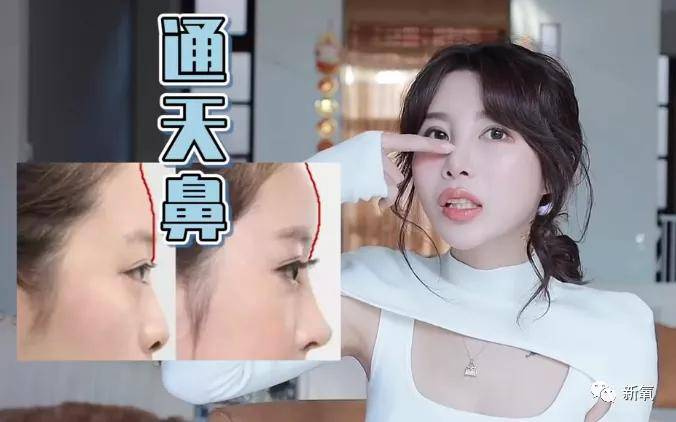 千万网红的10年整了5次鼻子这