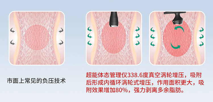 全球|全球首款体形综合管理仪-超能体态管理仪