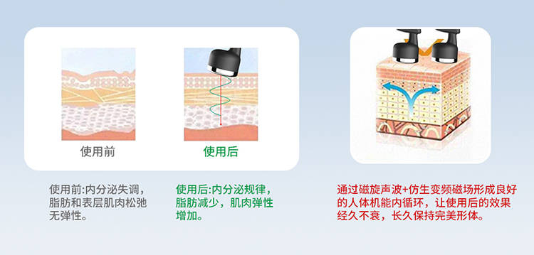 全球|全球首款体形综合管理仪-超能体态管理仪