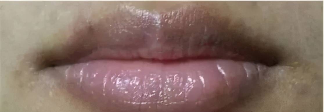 女生嘴巴出现这三种情况,可能就患有妇科病了_女性