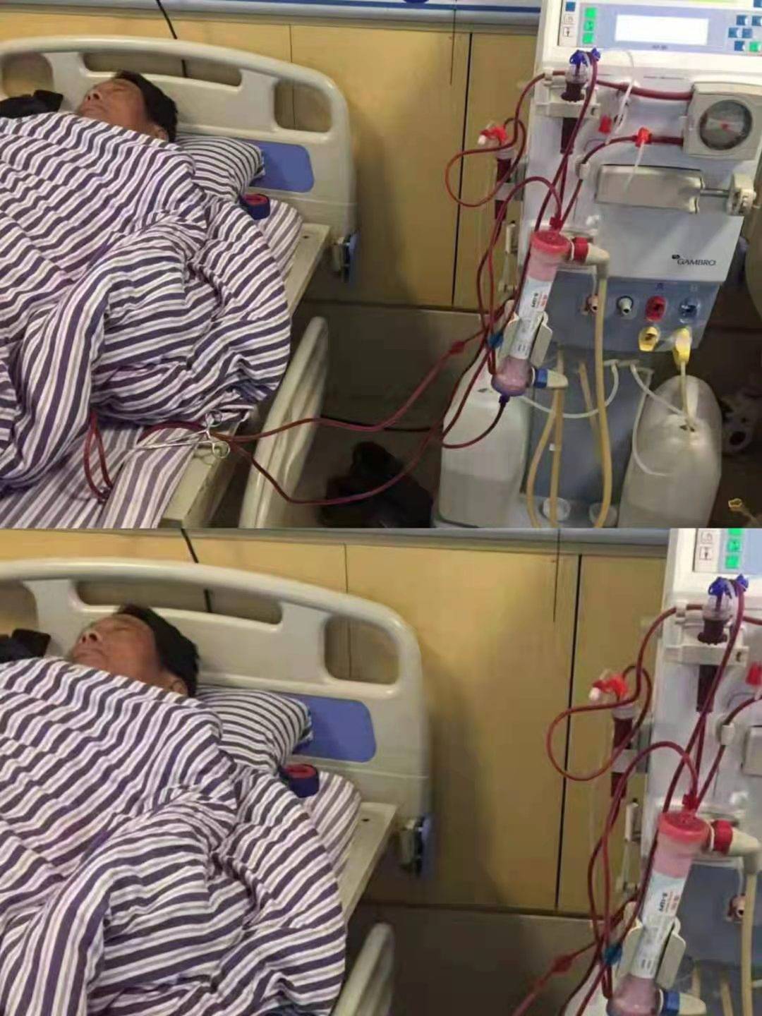 透析是不是要一辈子都透析 0dc9bd00b85c4fc0a4b2846092db7bc4.jpeg