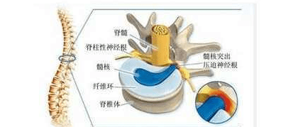 cdcce4133ece459f9190d95117be805a.png