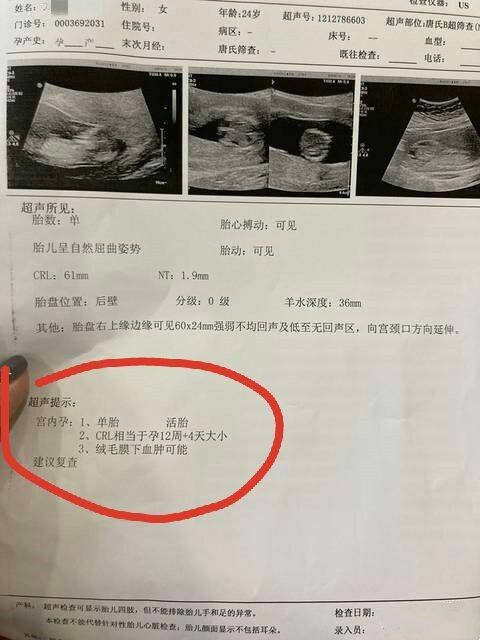 女24岁 试管后妊娠12周4天 8周4天的时候b超检查一切正常 血肿