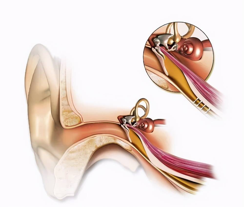 引起耳闷,耳鸣,耳聋的原因很多,如:外耳道耵聍栓塞,分泌性中耳炎,化脓