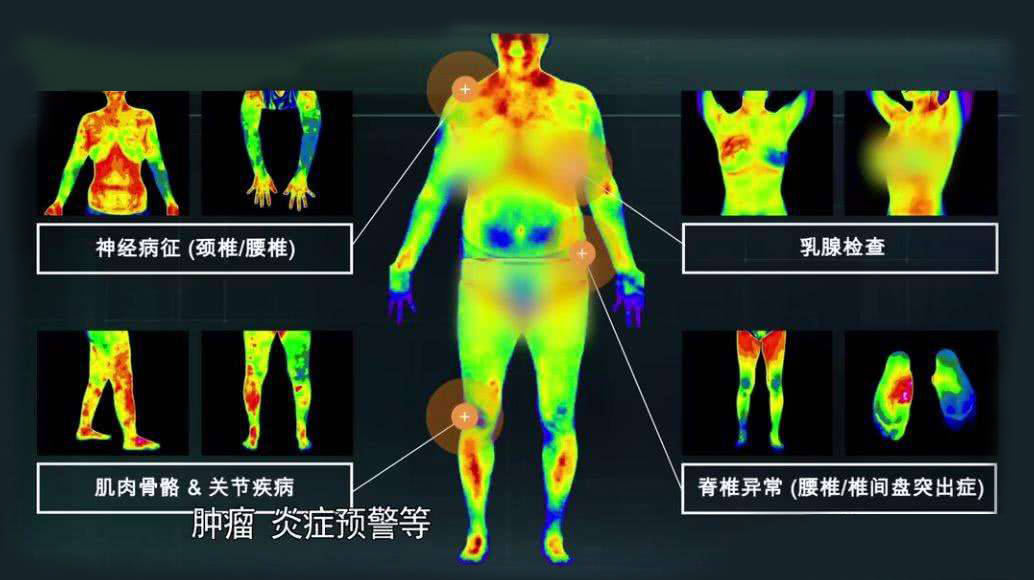 红外热成像健康管理设备可让你提前35年预见健康风险