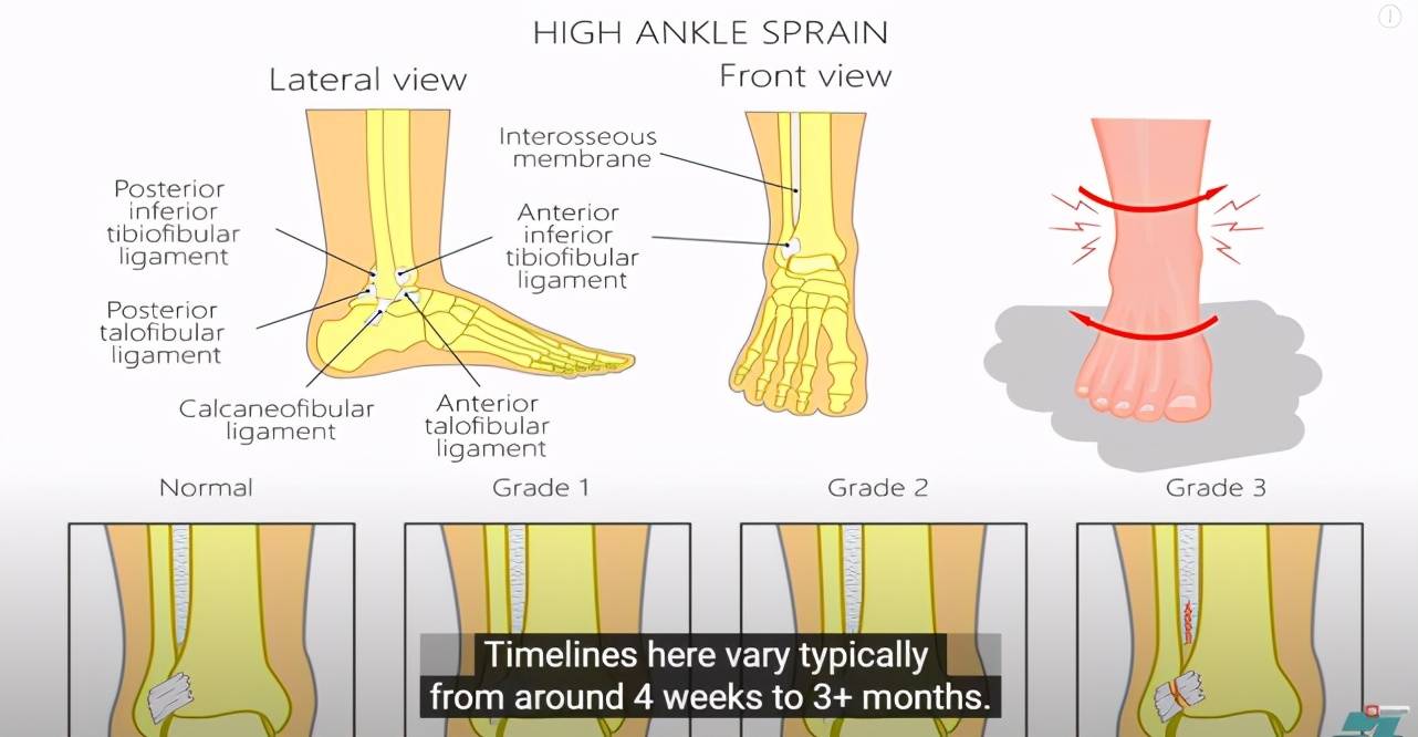 脚踝高位扭伤 无限期休战,老詹发推直言身心俱伤,mvp也无望?