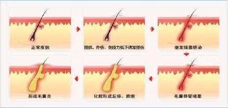 37750dc8112a45f2a7567965bd2eae89.jpeg