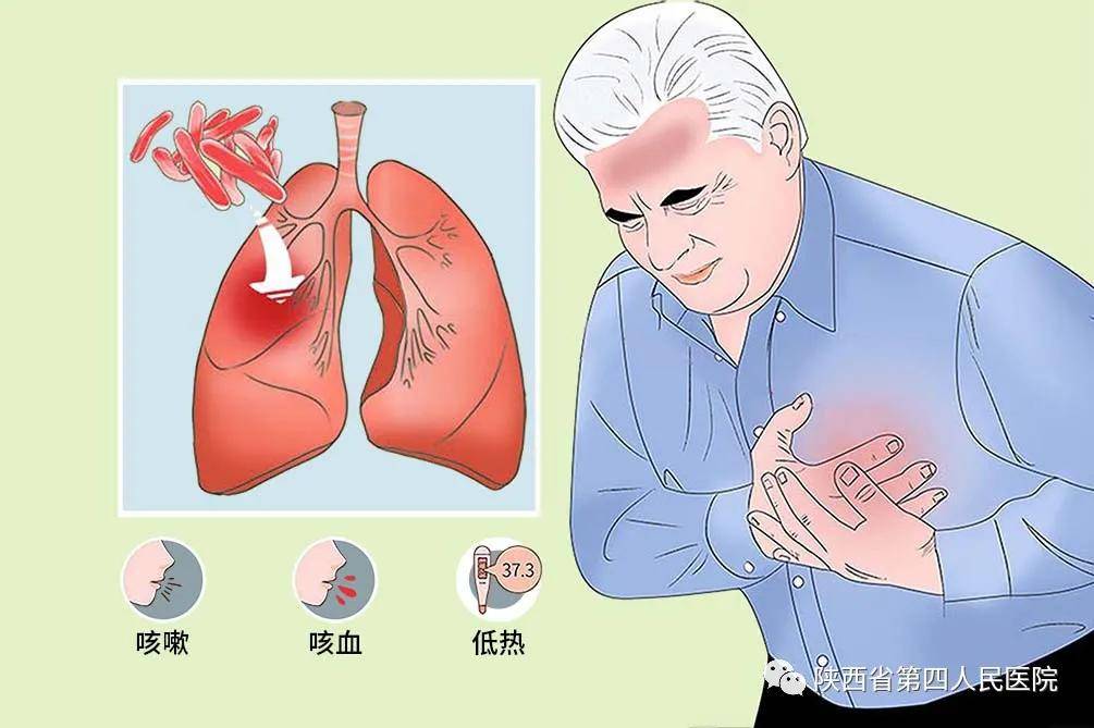 终结结核流行自由健康呼吸_手机搜狐网