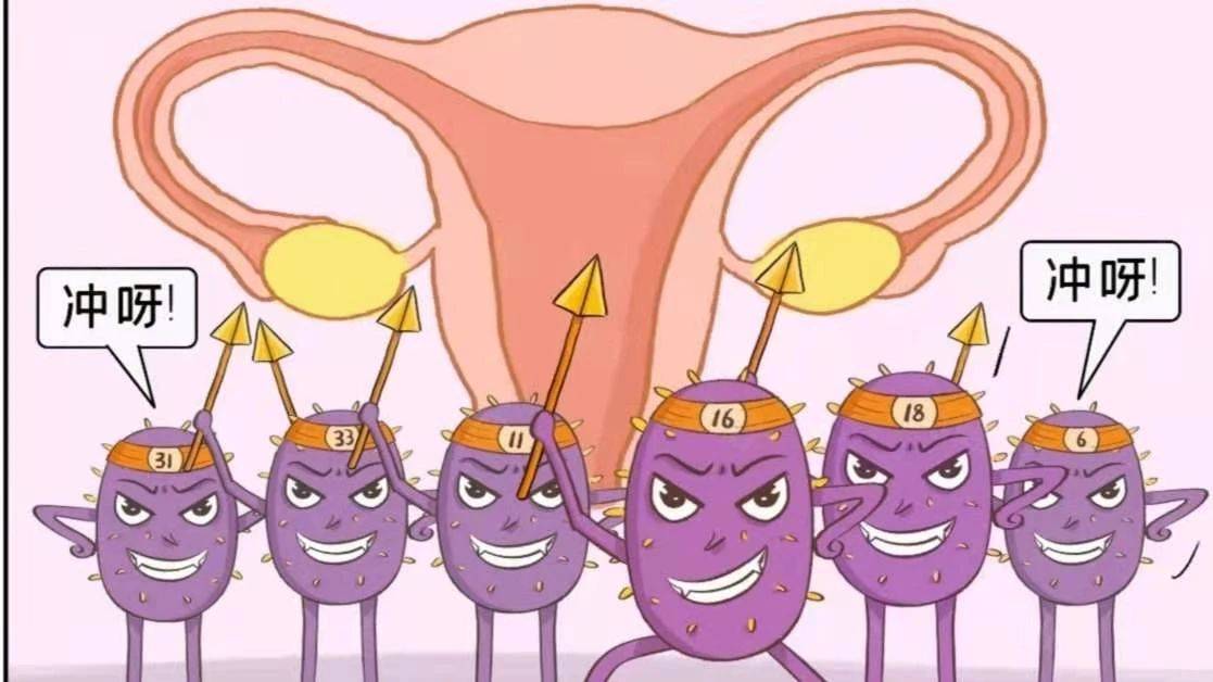 想远离宫颈癌最低只需1000元