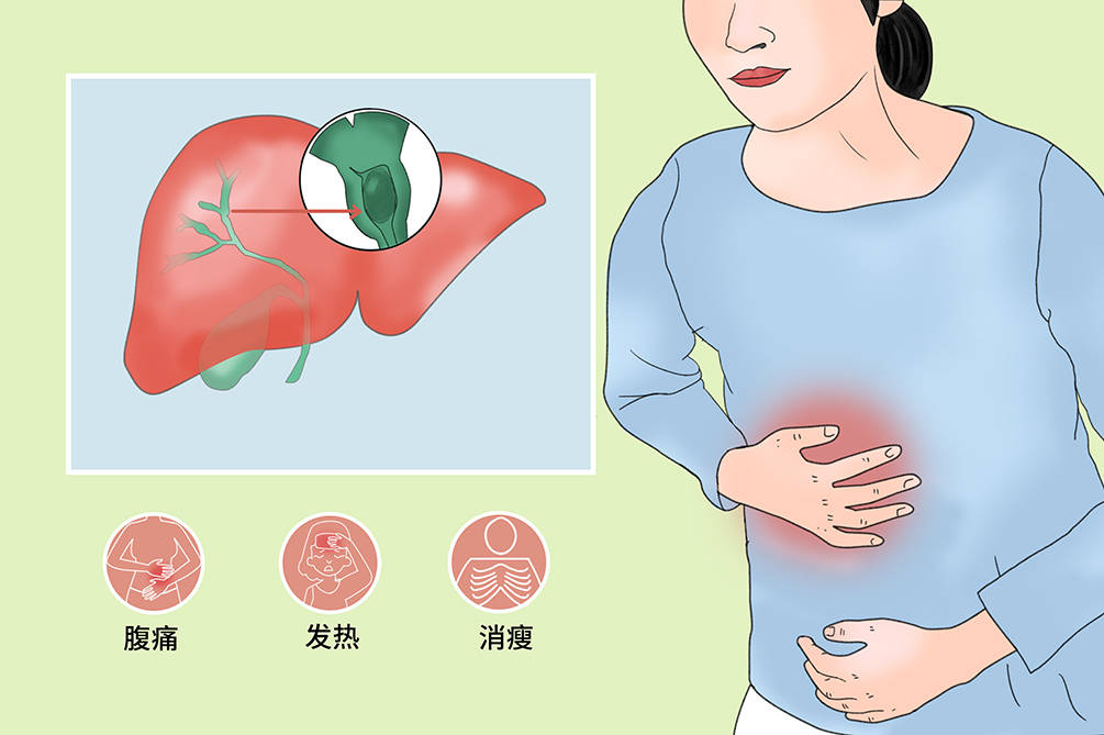 介入治疗,原装生活——梗阻性黄疸介入治疗篇_恶性肿瘤
