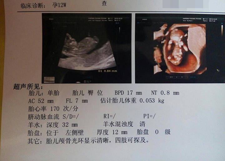 想孕育一个健康的宝宝都需要做哪些准备建议准妈妈提前看看