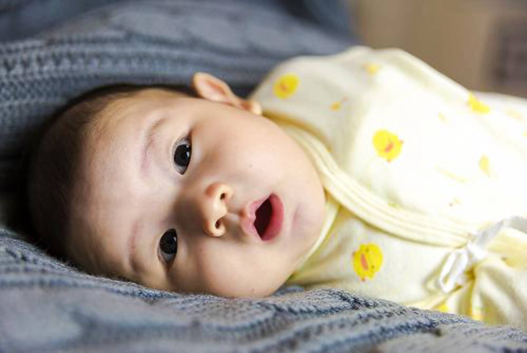 婴儿脑损伤的10大症状 新生儿智力低下的早期症状