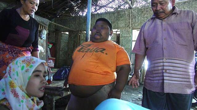 原创重220斤7岁男孩因肥胖离世,医生曾让手术减肥被其父母拒绝