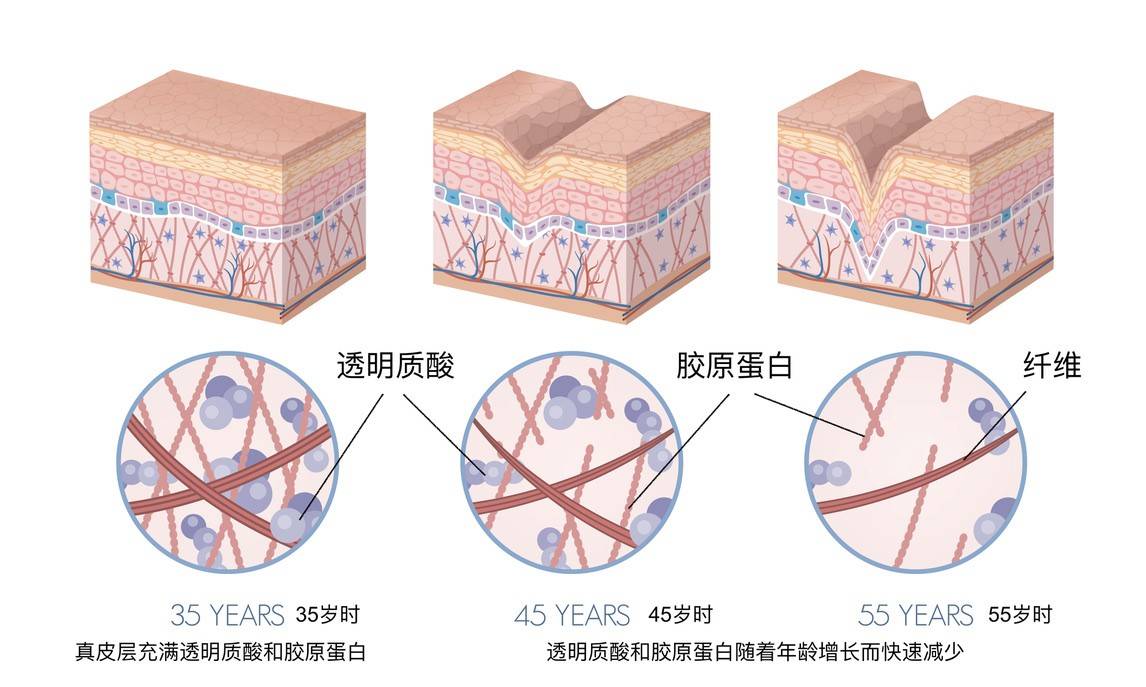 美颜秘笈–透明质酸玻尿酸的种种说法