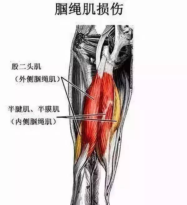 造成膝盖后侧疼痛的2个重要原因,和6组简单的康复训练!