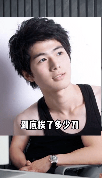 男网红不惧起诉,曝整容男星名单,还说王一博鼻子已出现挛缩现象