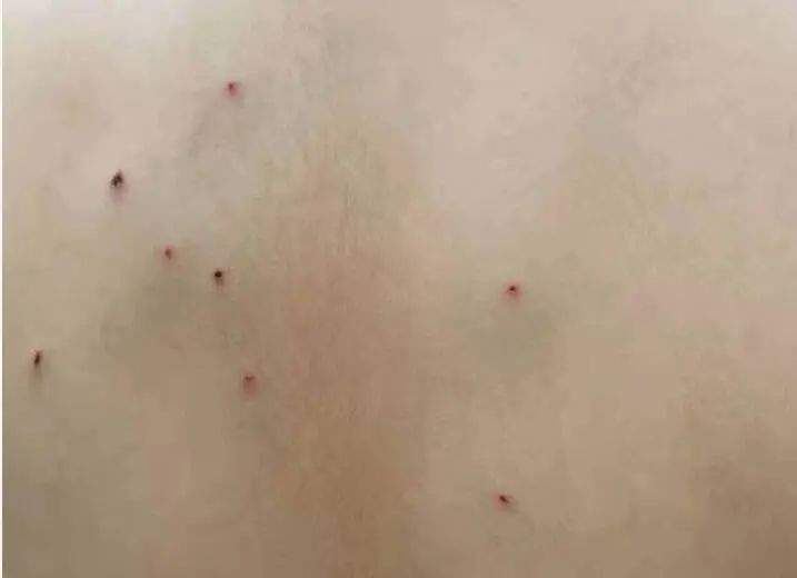 梦境的警示，梦见孩子后背被刺一孔流血过多而死