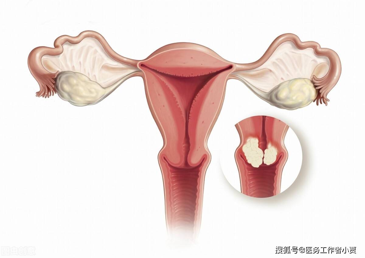 这种情况大多是接触后发生的