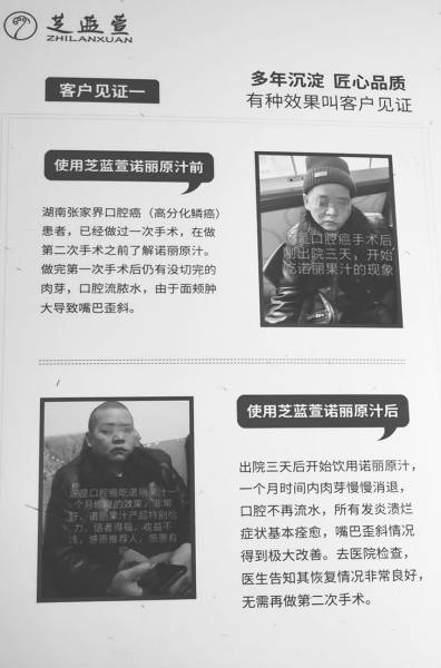 果汁和茶就能“调理”癌症？ 御理君腾被市监部门约谈(图4)