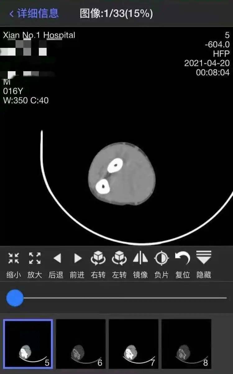 影像|西安市第一医院云影像来喽~告别纸质报告，手机绑定信息就能查看报告！