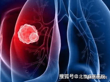 色素瘤长得快吗 59ad682af3f84ab9954b34cb7231ba8d.png