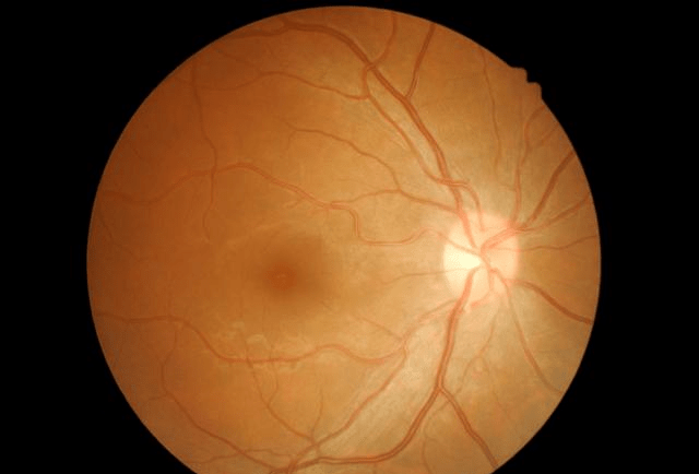 那是因为我们的眼球是不断移动的,对中央凹收集到分辨率的视觉信号