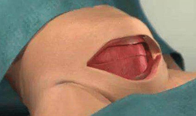 7a2a40b88f2e4d549acedffcbb51a920.jpeg