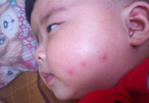 如何不被蚊子咬的方法 004992aaf3e34a2facef381a0ed36dac.jpeg