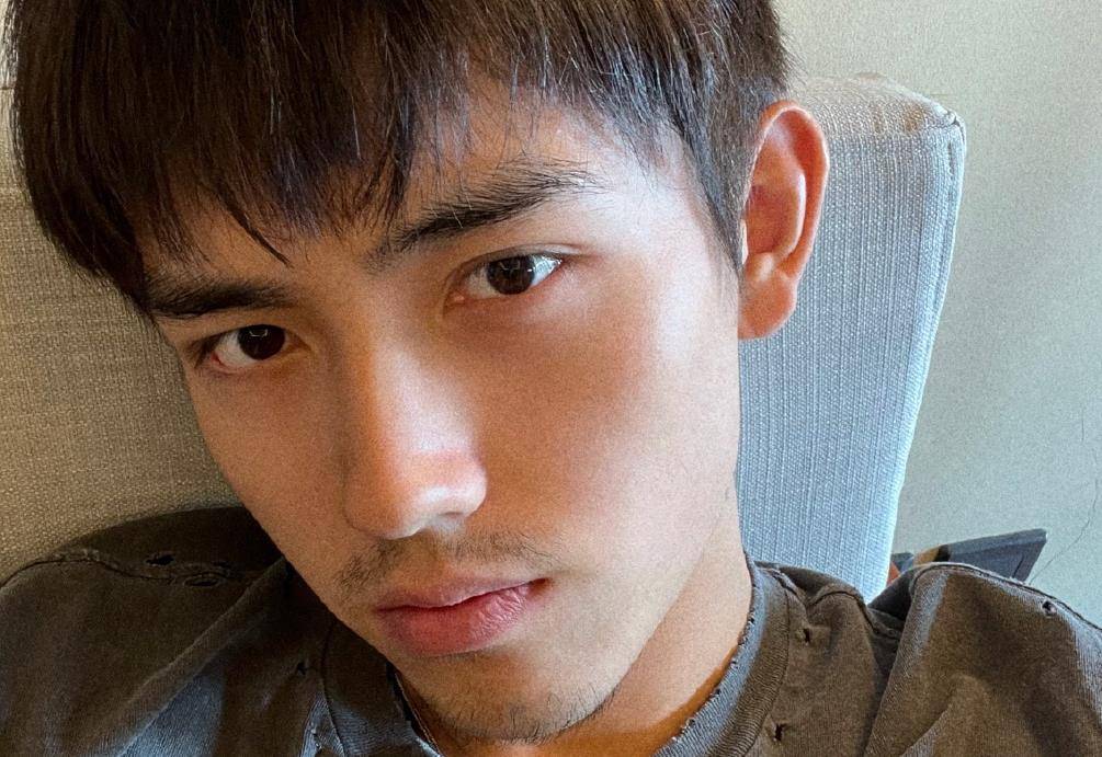 21岁陈飞宇近照:眼周状态不佳,肌肉走向奇怪,只能活在精修照里