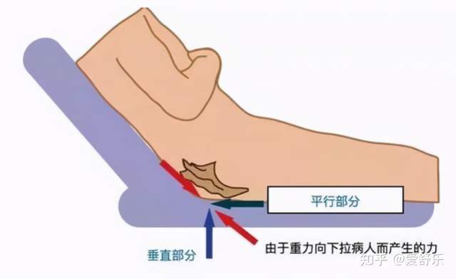 用纸尿裤过敏怎么办