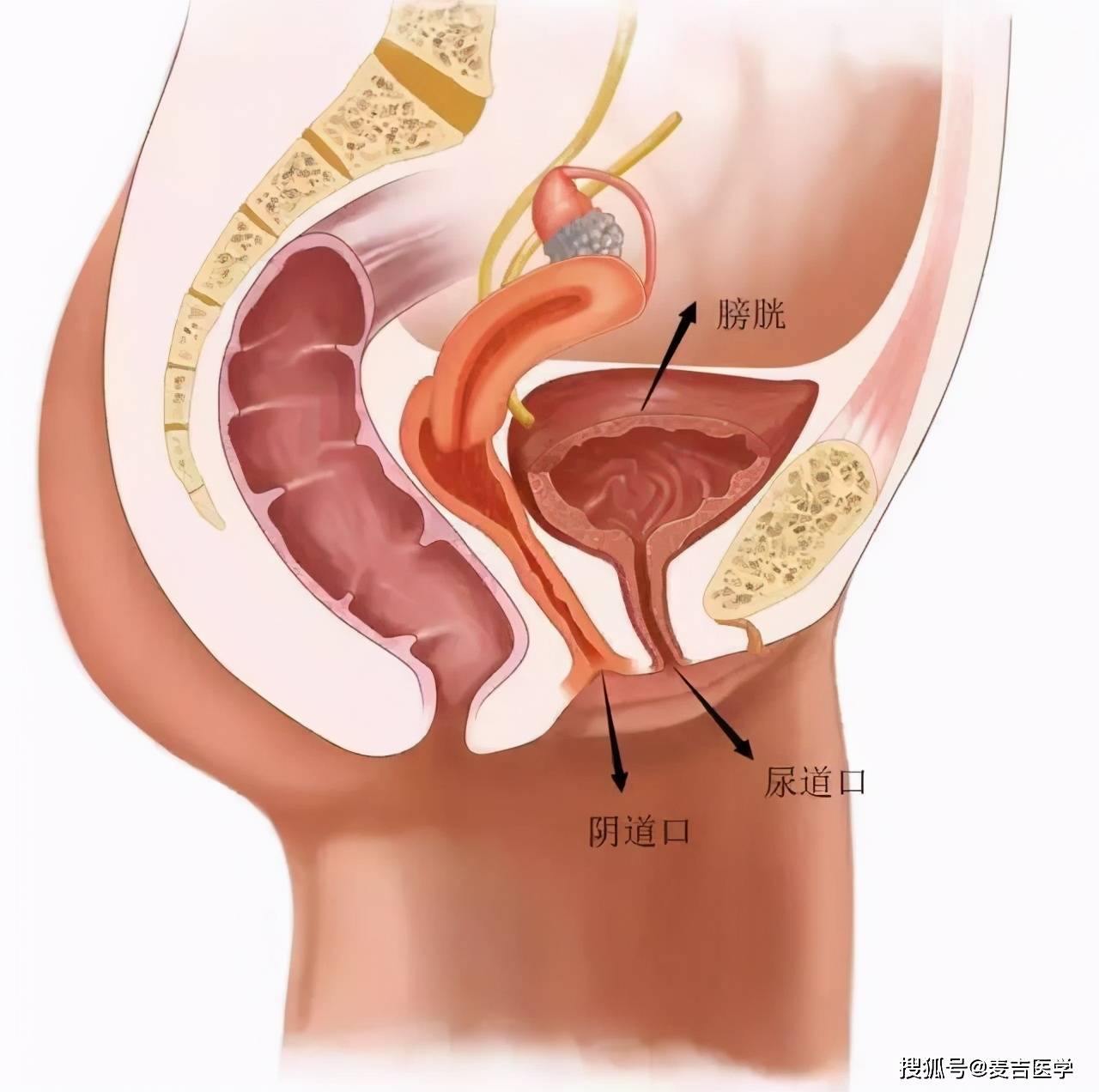 女性慢性膀胱偏方 膀胱炎吃什么药去根