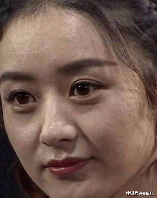 生完孩子之后赵丽颖的皮肤状态真的差了