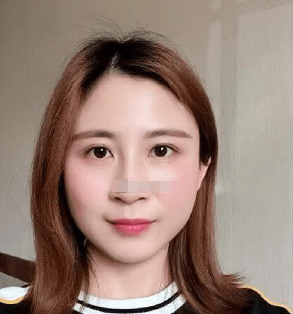 鼻大嘴小气量小喜欢计较法令纹有痣中年工作会出现大问题