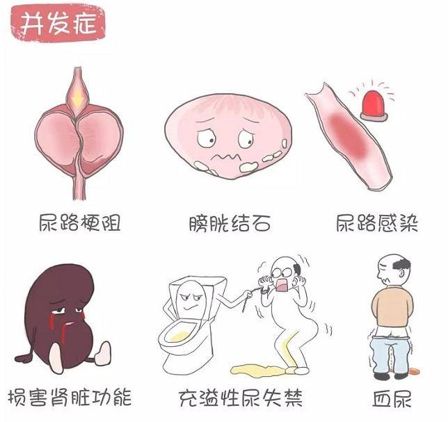 民以食为天但前列腺增生患者请注意这4种食物真的不能吃